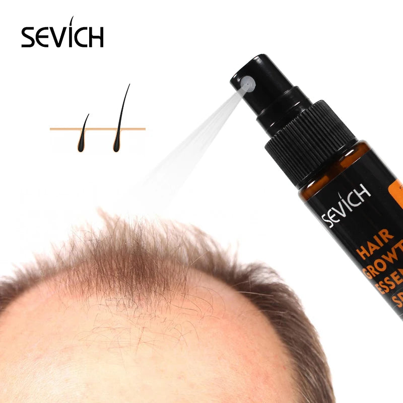 Sevich Hair Growth Essence Spray - Revitalize Thinning Hair & Promote Regrowth (30ml)