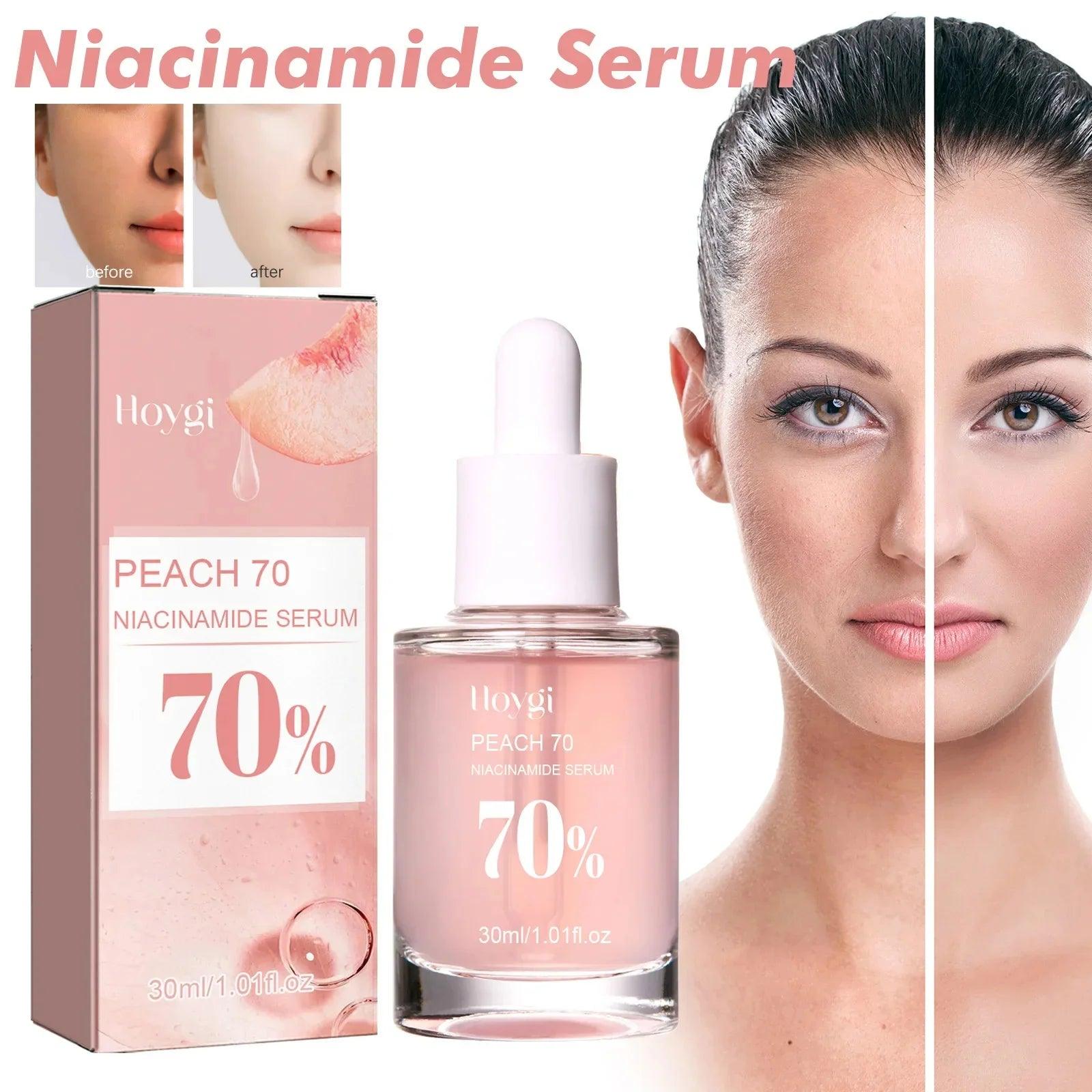 Peach 70% Niacinamide Serum 30ml Moisturizing Prevent Dryness Facial Essential Oil Increasing Elasticity Smooth Soften Skin Care - Urbanew