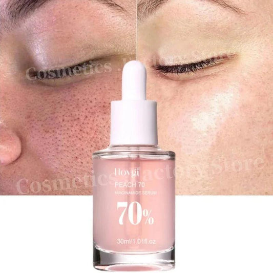 Peach 70% Niacinamide Serum 30ml Moisturizing Prevent Dryness Facial Essential Oil Increasing Elasticity Smooth Soften Skin Care - Urbanew