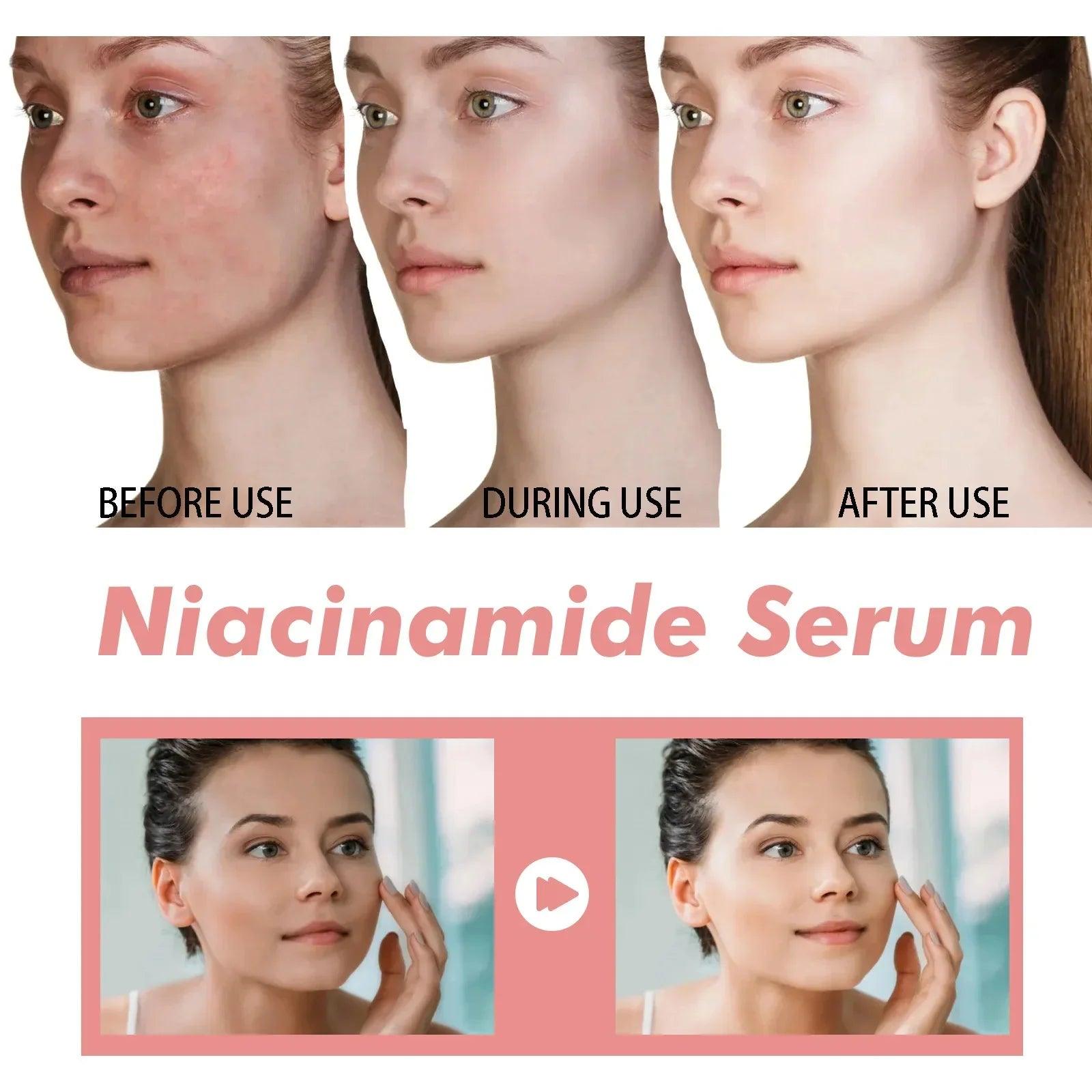 Peach 70% Niacinamide Serum 30ml Moisturizing Prevent Dryness Facial Essential Oil Increasing Elasticity Smooth Soften Skin Care - Urbanew