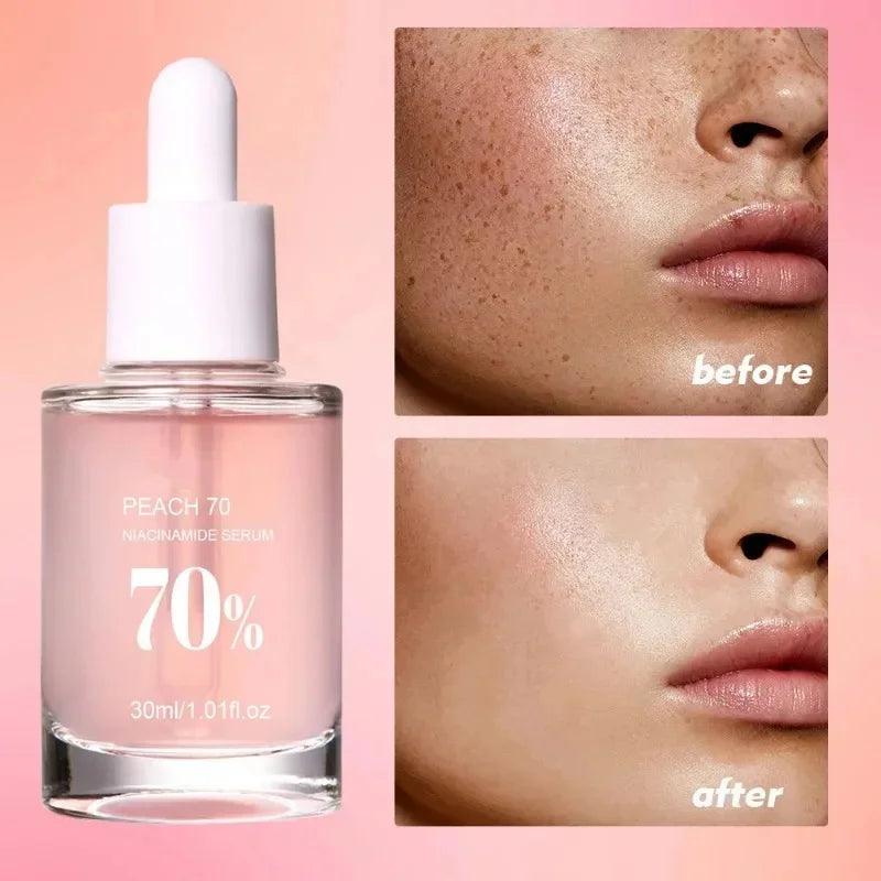 Peach 70% Niacinamide Serum 30ml Moisturizing Prevent Dryness Facial Essential Oil Increasing Elasticity Smooth Soften Skin Care - Urbanew